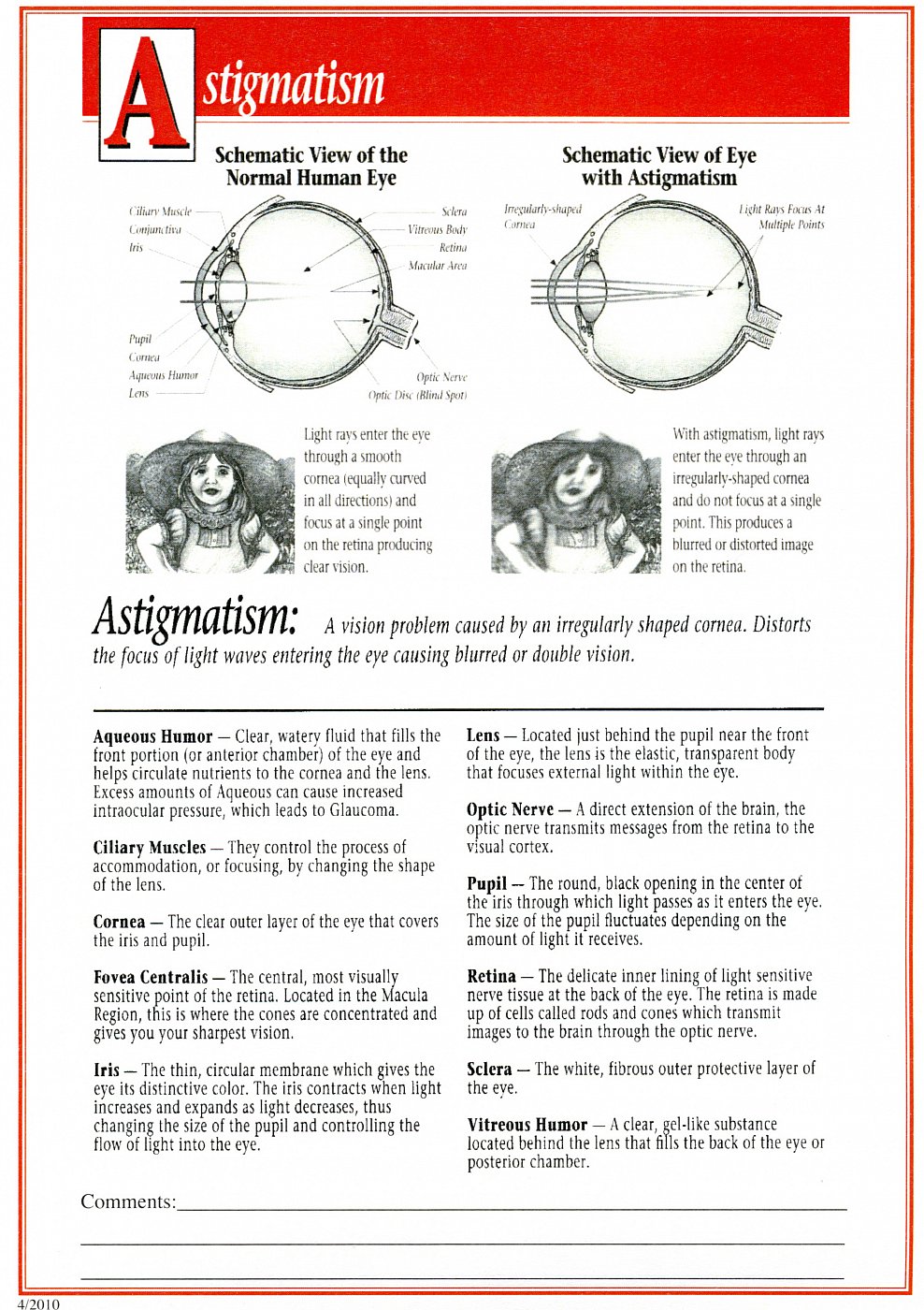 dr-roy-coosa-eye-astigmatism