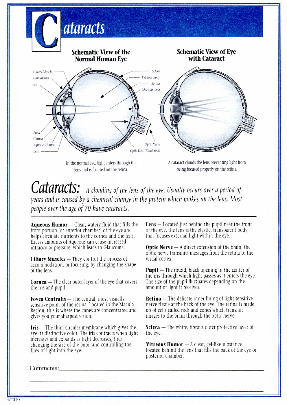 dr-roy-coosa-eye-cataracts