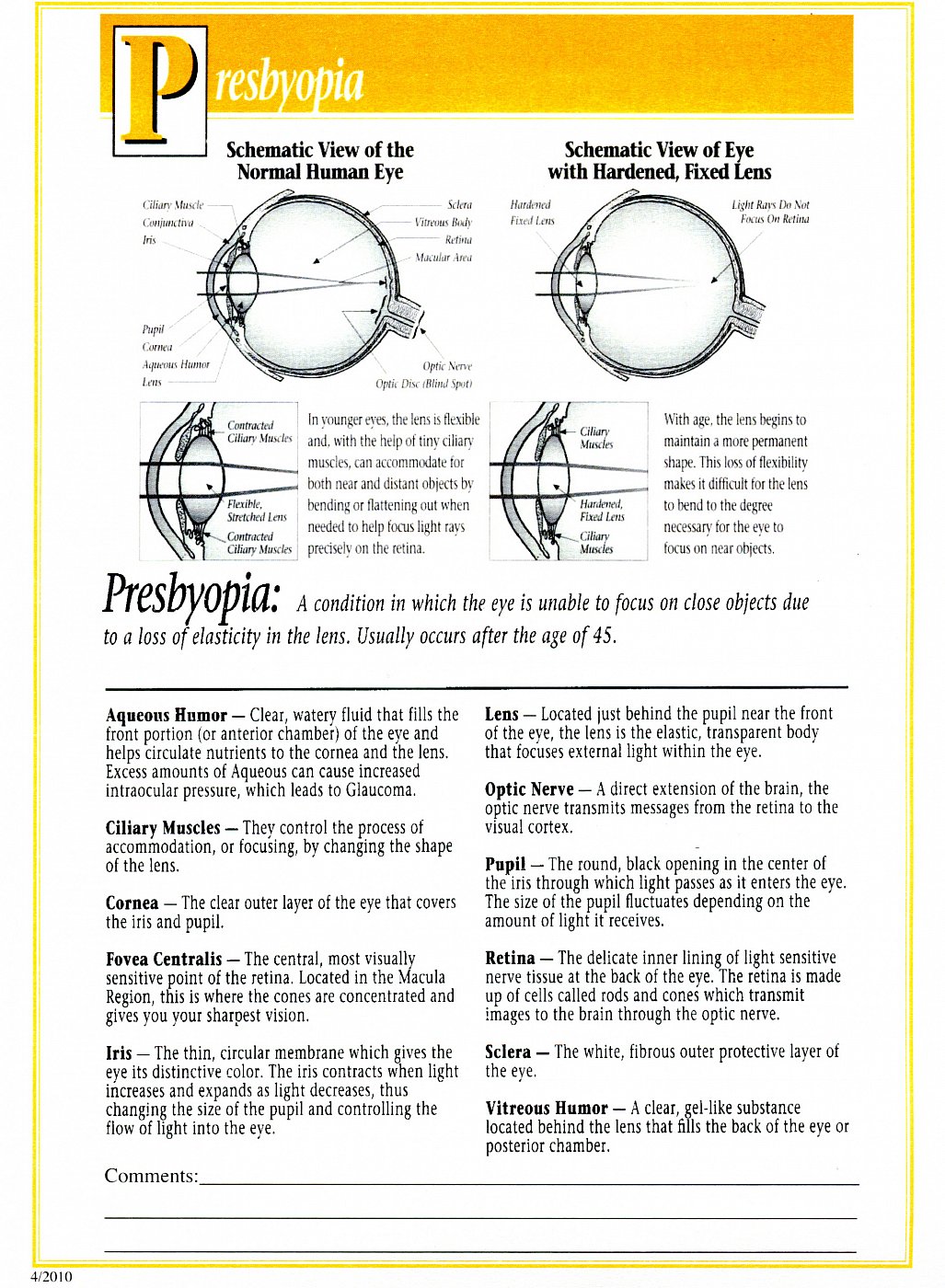 dr-roy-coosa-eye-presbyopia